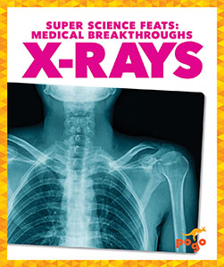 Cover Art for X-Rays